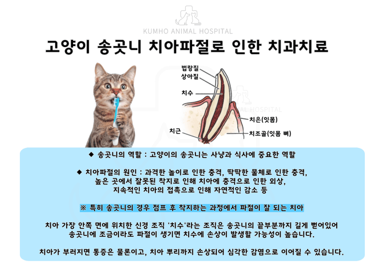 신경치료