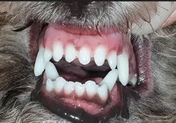 앞니와 잇몸 상태 가이드