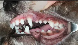 왼쪽 어금니 안쪽 가이드