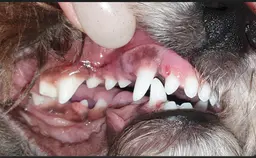 오른쪽 어금니 안쪽 가이드